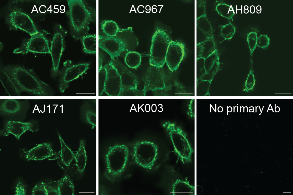 ABCD_AC459, ABCD_AJ171, ABCD_AK003 and ABCD_AH809 antibodies recognize ...